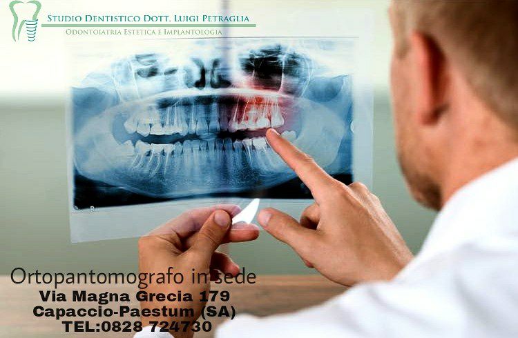 Le più moderne tecnologie radio-diagnostiche. Le tue ortopantomografie in sede