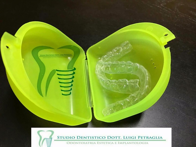 Trattamento INVISALIGN