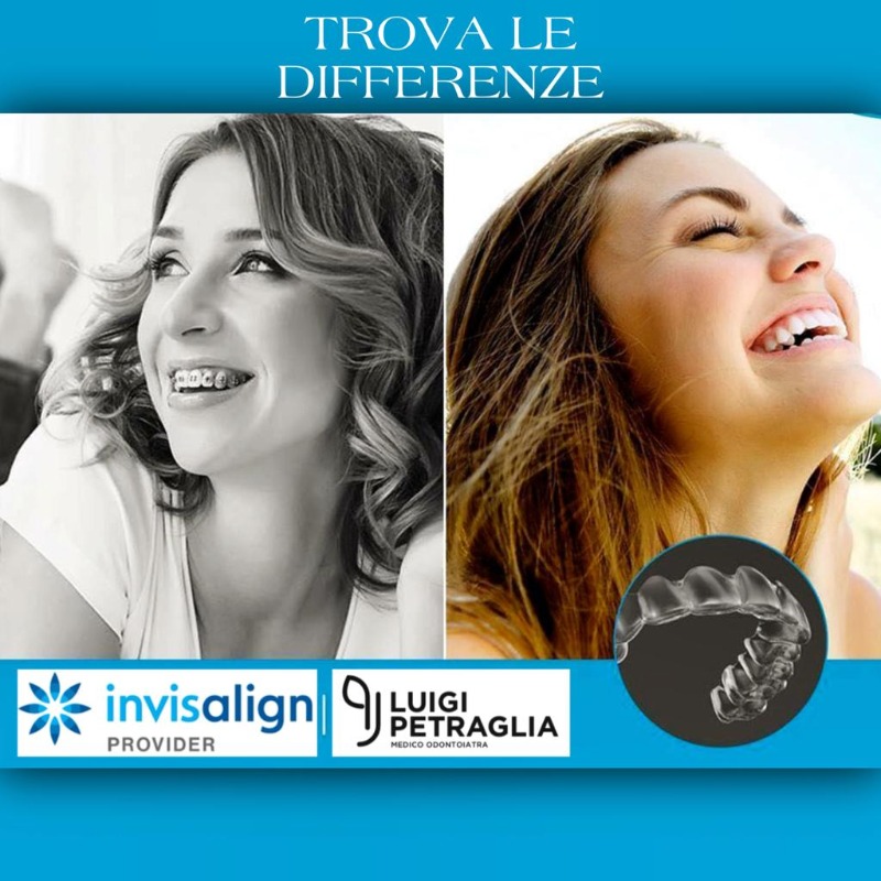 Dott Luigi Petraglia Invisalign Provider