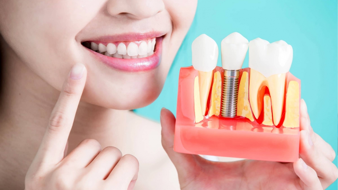 Non vorrai aver paura di sorridere? Scegli noi  #dentista #dental #studiodentisticopetraglia #capaccio