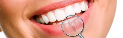 Noi al tuo Sorriso ci Teniamo #dentista #dental #studiodentisticopetraglia #capaccio