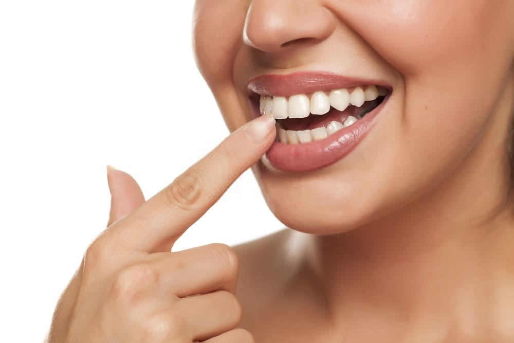 Intarsi dentali #dentista #dental #dentalsmile