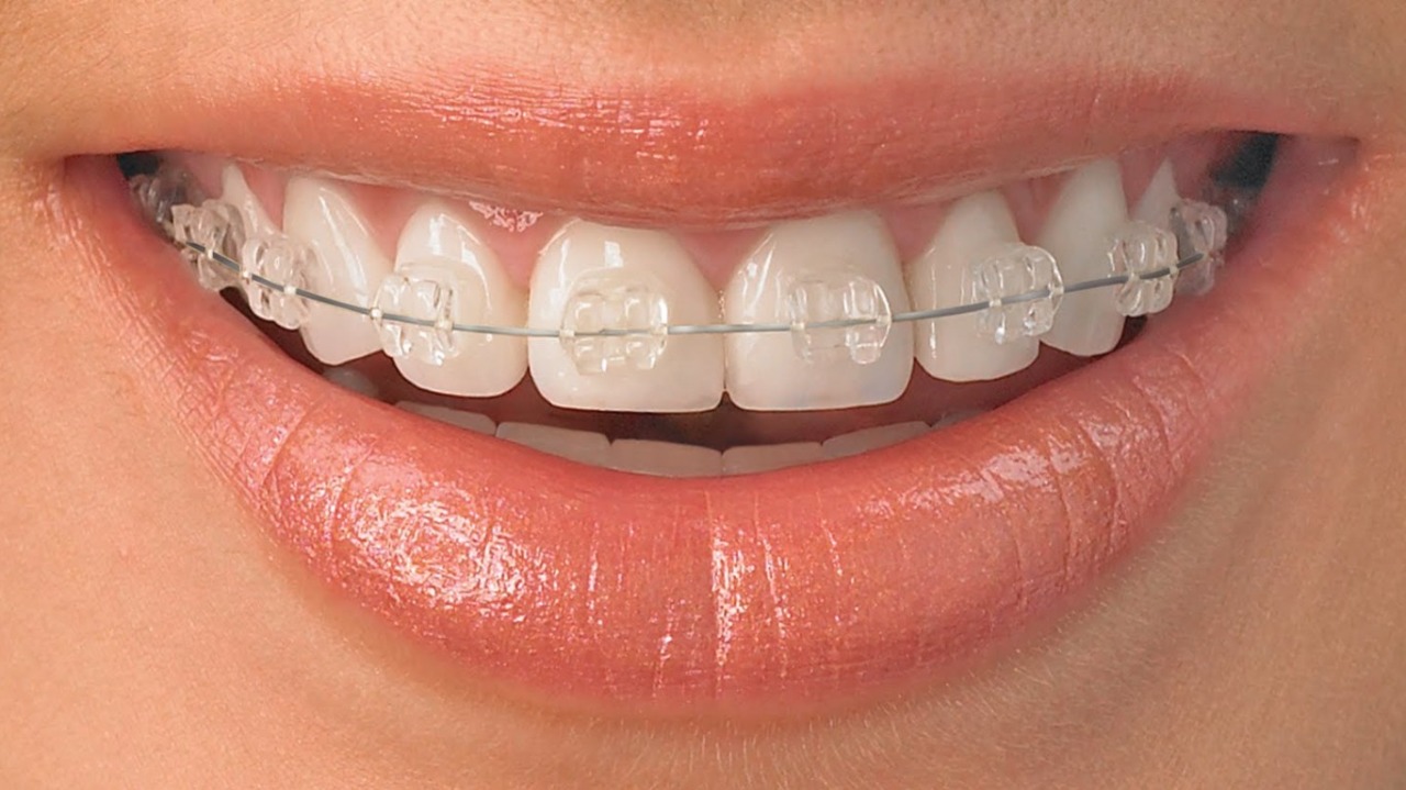 Ortodonzia #dentista #dental #dentalsmile
