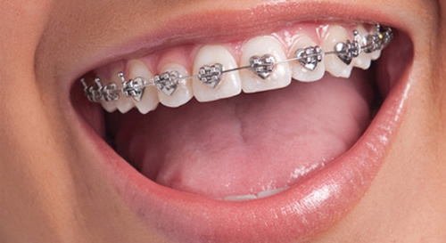 Ortodonzia #dentista #dental #dentalsmile