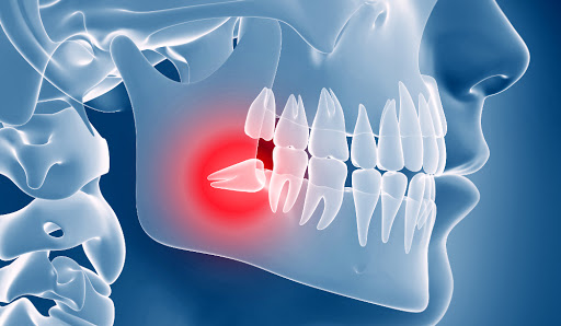 Risolviamo i problemi dei vostri denti #dentista #dental #dentalsmile