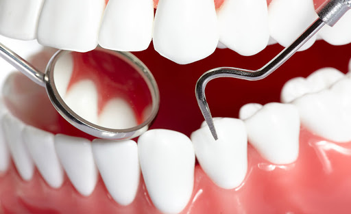 Prevenire è meglio che curare.  #dentista #dental #studiodentisticopetraglia #capaccio